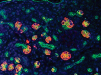 Image: An intermediate cell type, which emerges during inflammation and regeneration in acute pancreatitis regulated by the transcription factor Prrx1, termed acinar-to-ductal metaplasia (Photo courtesy of Maximilian Reichert, MD, Perelman School of Medicine, University of Pennsylvania).